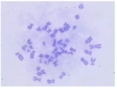 picture of human chromosomes